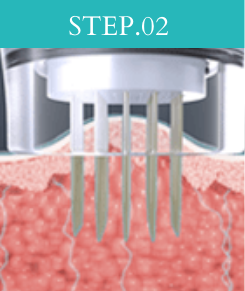 STEP02
