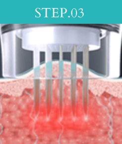 STEP03