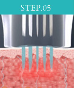 STEP05
