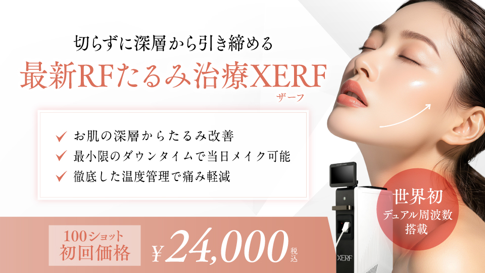 XERF（ザーフ）