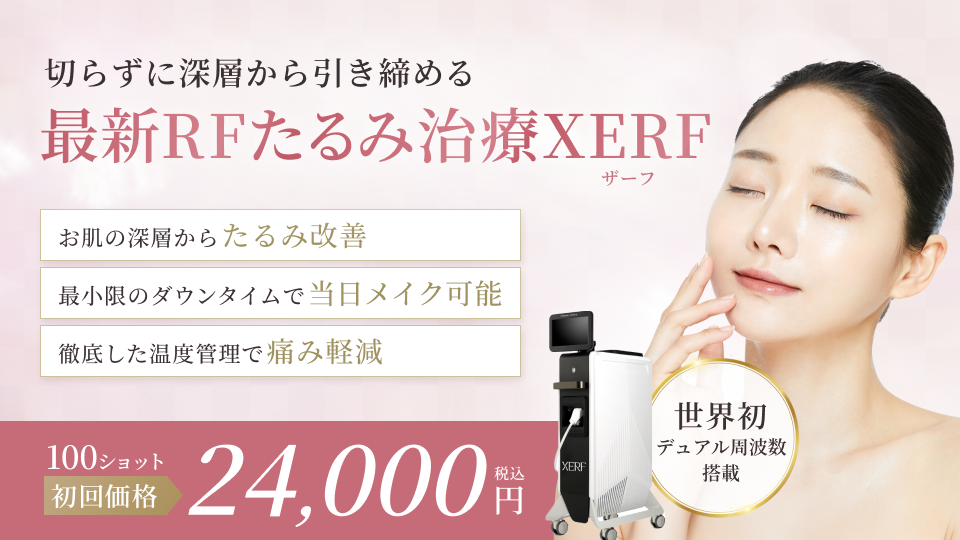 XERF（ザーフ）